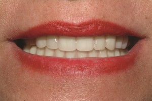 Figure 6 Minda Smile
