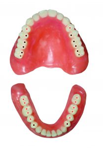 Schéma 1 occlusion setup