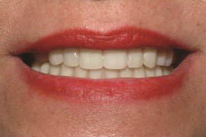 Figure 6 Minda Smile