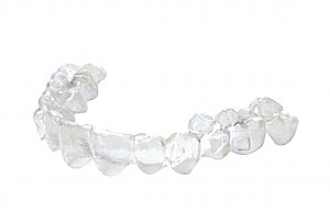 invisalign, braces, aligner